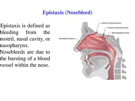 Analyzing the Symbolic Meanings of Epistaxis in Varying Dreamscapes