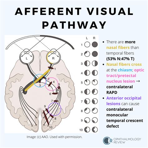 Coping with the Emotional Impact of Never-Ending Pathway Vision