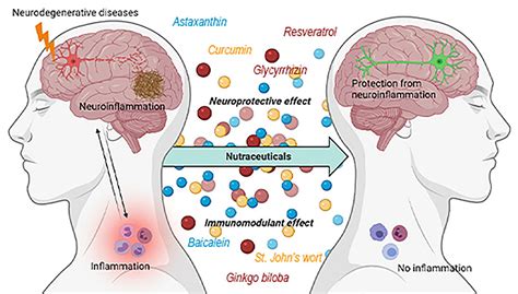 Could Brain Transplantation Hold the Key to Treating Neurodegenerative Diseases?