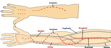 Cultural Perspectives on the Symbolism of the Incision on the Upper Limb