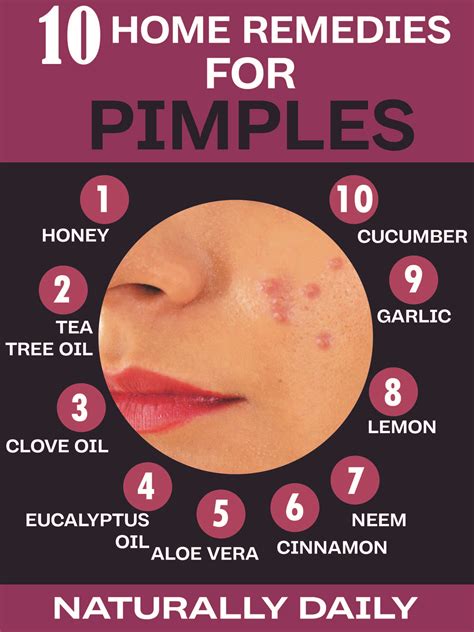 Dealing with Acne and Pimples