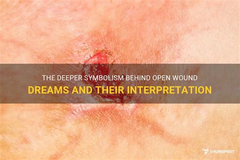 Deciphering the Hidden Meanings: Exploring the Symbolism behind Physical Wounds