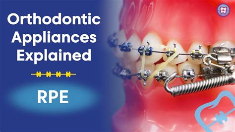 Deciphering the Significance of Orthodontic Appliances in Dream Interpretation