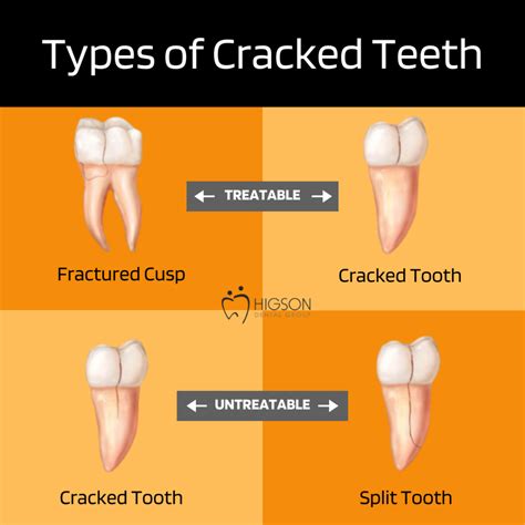 Deciphering the Symbolic Meaning of a Cracked Incisor