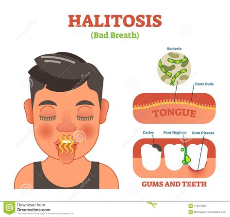 Decoding Dreams of Disagreeable Oral Halitosis: Deciphering Their Significance