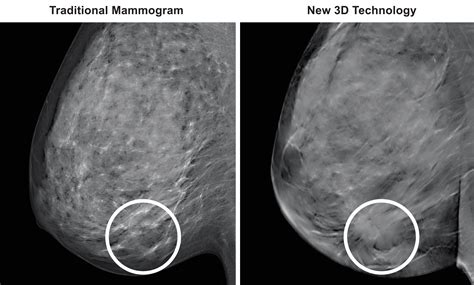 Decoding the Hidden Significance of Imaging Deformed Breasts