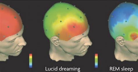 Delving into the Fascinating Concept of Dreaming