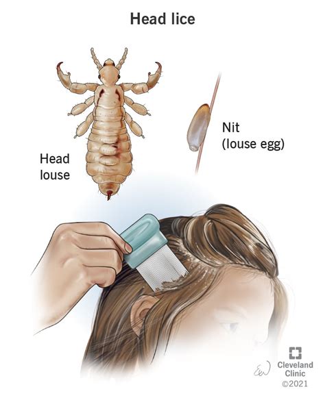 Examining the Potential Warnings and Omens Associated with Lice Dreams