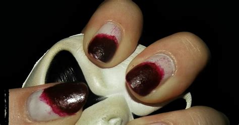 Exploring Potential Causes of Dreams Incorporating the Phenomenon of Bloodied Nails