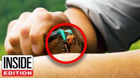 Exploring the Anxiety of Getting Stung by Hornets