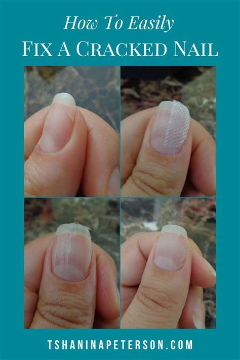 Exploring the Psychological Meanings Behind Cracked Nail Illusions