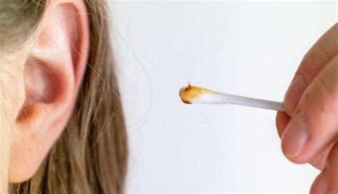 Exploring the Psychological Significance of Dreaming about Cleaning Earwax
