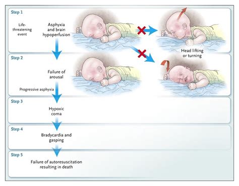 Factors Contributing to Infant Death: Connecting SIDS and Congenital Anomalies
