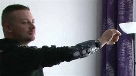 From Science Fiction to Reality: Breaking Barriers with Bionic Limbs