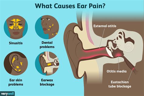 Identifying the Causes: Common Culprits of Ear Discomfort while Sleeping