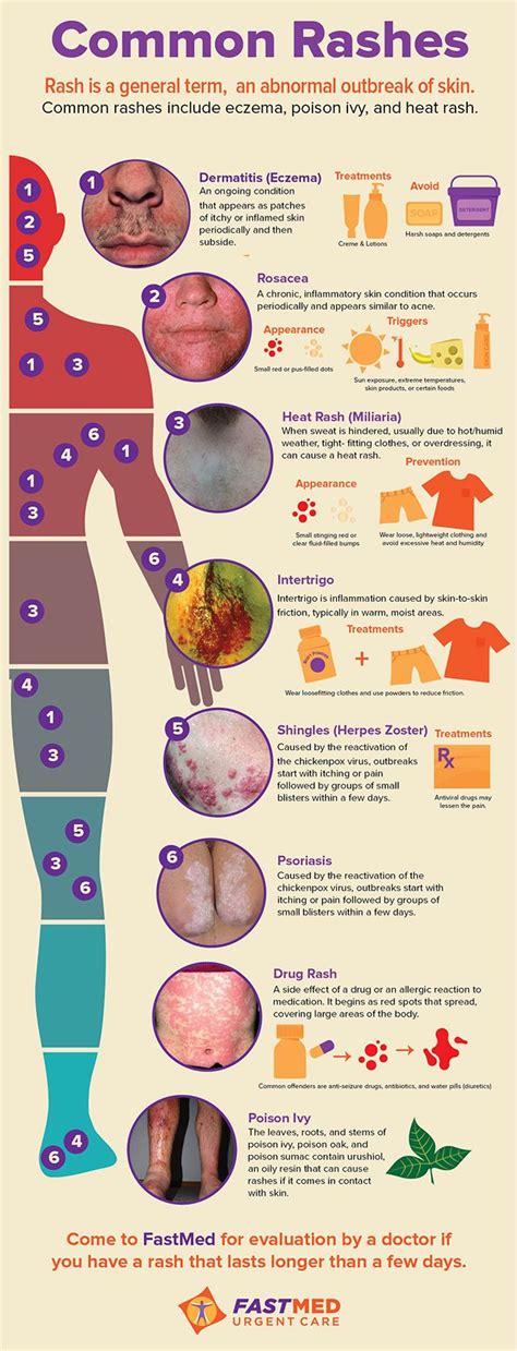 Identifying the Common Triggers of Rash on Legs in Dreams