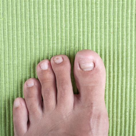 Insight into Your Emotional State through Dreams of Foot Toenails