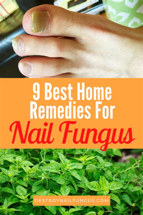 Natural Nail Remedies: Effective Home Treatments for Common Nail Issues