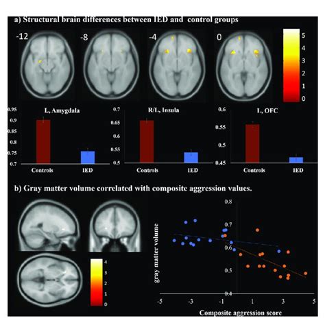 Neurological Insights: Brain Activity during the Experience of Flight within an Enclosed Space