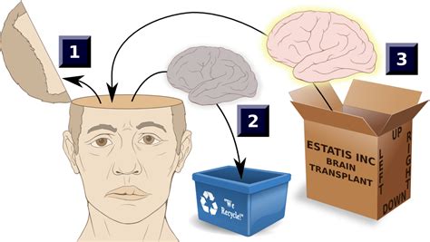 Neuroscience and Brain Transplants: Understanding the Challenges