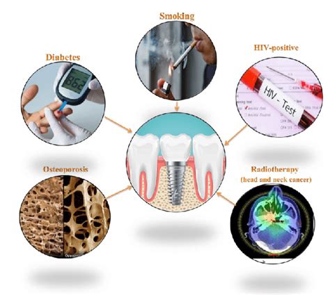 Possible Factors Contributing to Dental-related Dreams