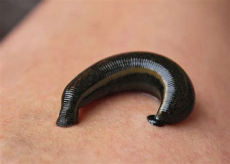 Practical Tips for Processing and Understanding Dreams of Leech Bites