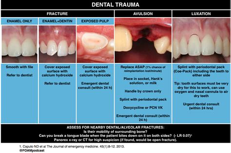 Restoring the Balance: Effective Solutions for Dental Fractures