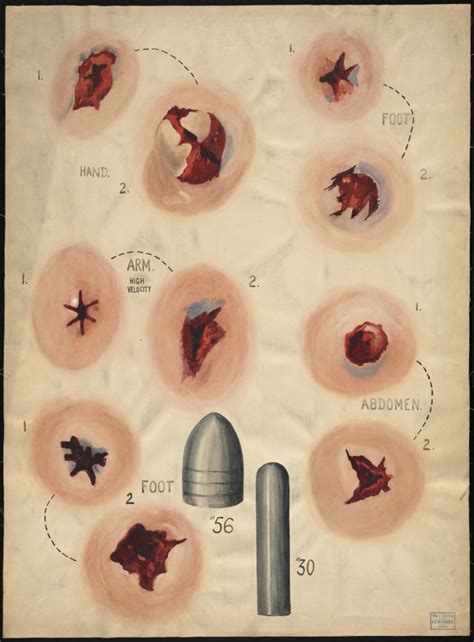 Symbolic Meanings of Abdominal Gunshot Wounds in Different Cultures