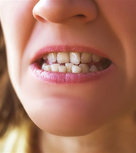 The Biological Factors Behind Dreams of Crowded Teeth