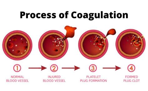 The Enigmatic Connection between Dreams and Blood Coagulations