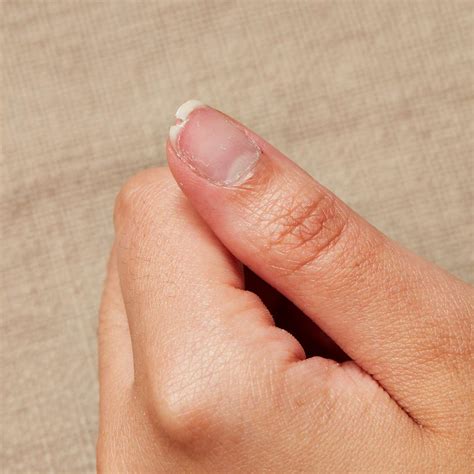 The Fascinating Significance Behind Dreams of Shattered Nail Tips