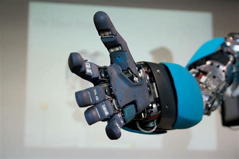 The Future of Prosthetics: Advancements in Bionic Limbs