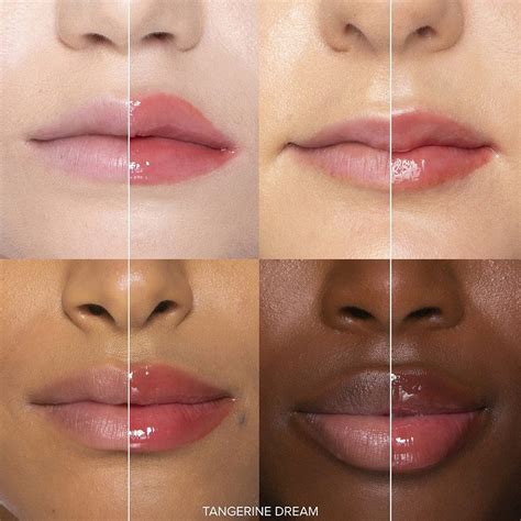 The Growing Popularity of Plumper Lips: An Insight into Lip Enhancements