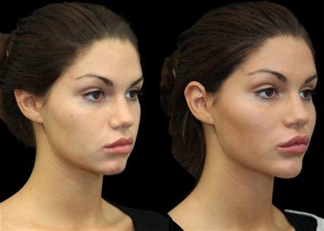 The Intriguing Phenomenon of Feminine Facial Growth