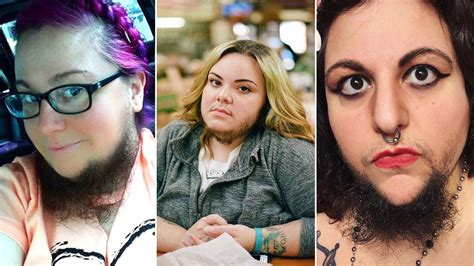 The Link between Facial Hair in Women and Gender Identity