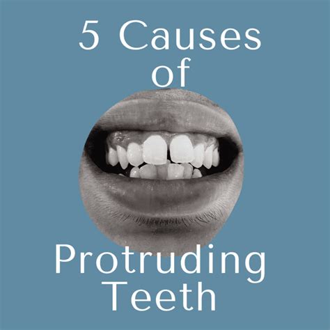 The Origins and Genetic Factors Associated with Protruding Teeth