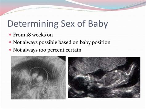 The Science of Determining the Sex of a Baby Prior to Birth