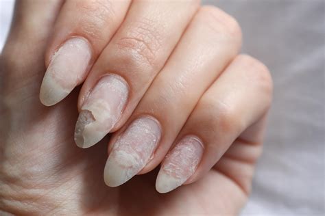 The Significance of Dreams Involving Damaged Nail Extensions