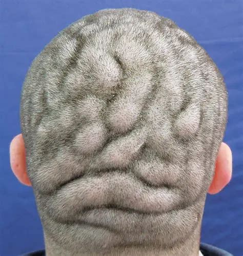 The Significance of a Bald Patch on the Scalp in Dream Interpretation