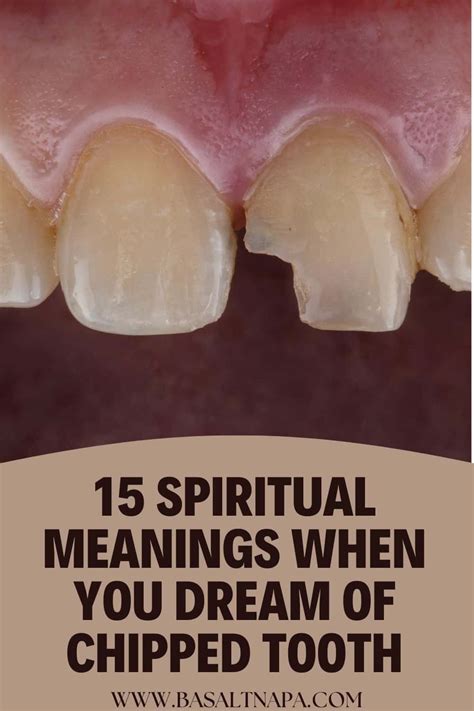 The Symbolic Meaning of Decayed Teeth in the Realm of the Unconscious