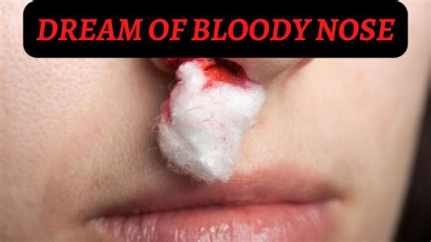 The Symbolic Significance of a Bloody Nasal Discharge in Dreams