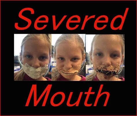 Tips for Coping with Repeating Nightmares of a Severed Mouth