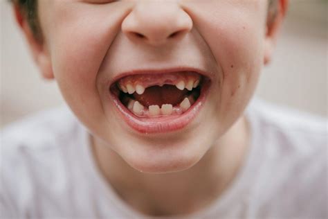 Tips for Understanding and Dealing with Dreams Involving the Loss of a Child's Teeth