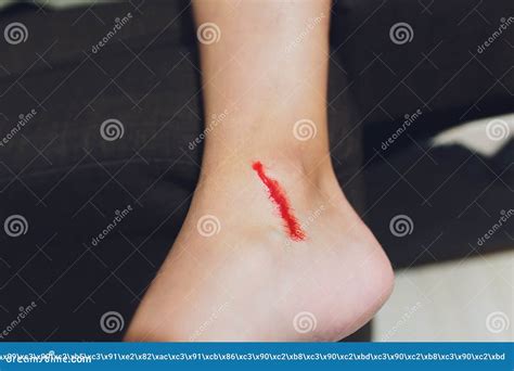 Understanding and Analyzing Dreams Involving Leg Bleeding