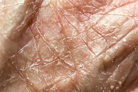 Understanding the Origins of Poor Skin Condition