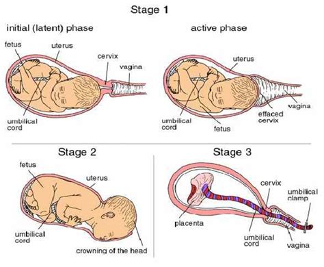 Understanding the Phases of Childbirth