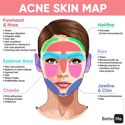 Understanding the Root Causes of Facial Acne