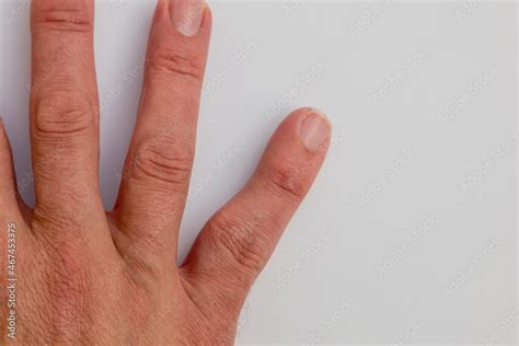 Unearthing the Causes Behind Distorted Finger Dreams