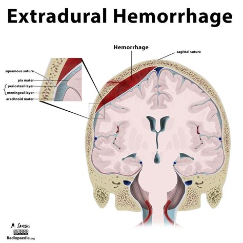 Unraveling the Symbolic Significance of a Hemorrhaging Scalp