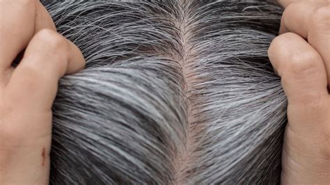 Unveiling the Genetic Mystery: Understanding the Enigma of Children with Premature Greying Hair